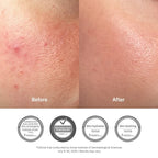 Skin before and after use, with clinical test badges
