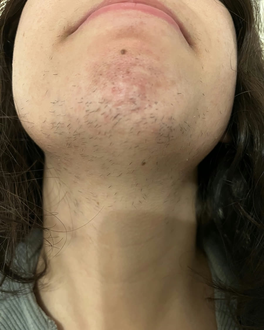 Before — customer photo