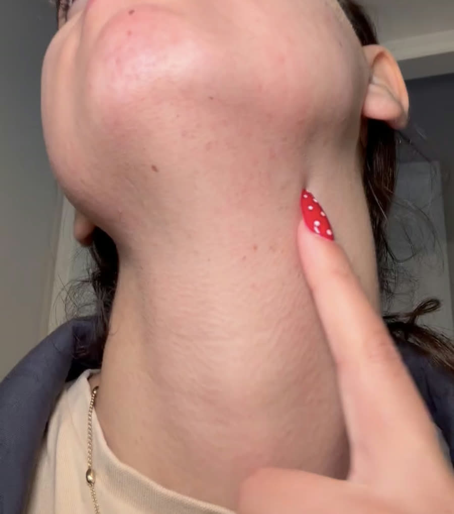 After — customer photo