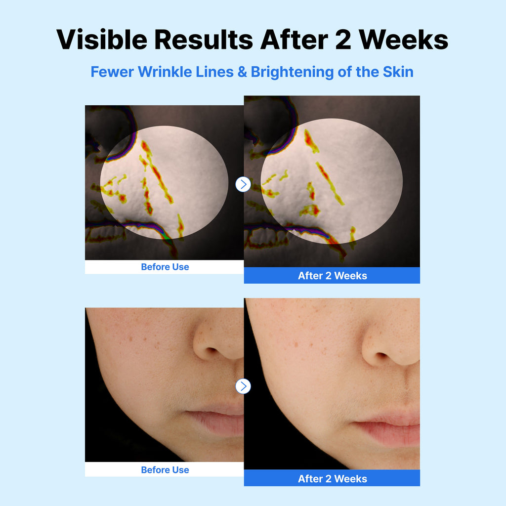 NIDA serum1 — product detail 4