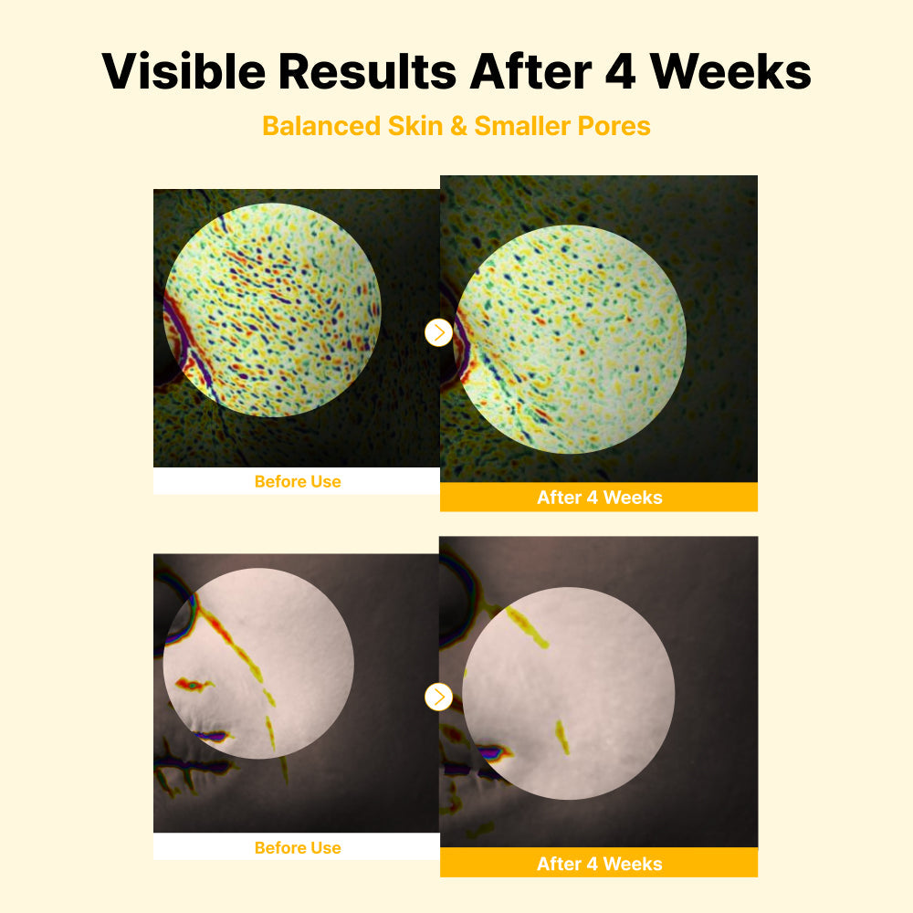 NIDA serum2 — product detail 4