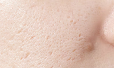 🕳️ Pores