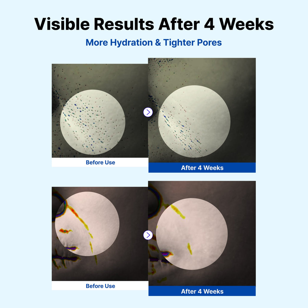 Original NIDA manufacturer before-and-after study images